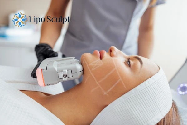 HIFU vs Botulinum Toxin: Understanding the Differences 1 HIFU vs Botox Burgess Hill What is the best option for you?