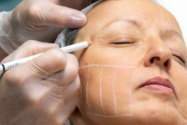 CryoPen: 5 Skin Concerns It May Be Used to Treat 4 What should you ask before having CryoPen treatment Burgess Hill?