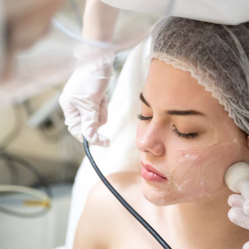 Why Do People Choose HIFU for a Non-Surgical Facelift? 5 What are the risks Burgess Hill?